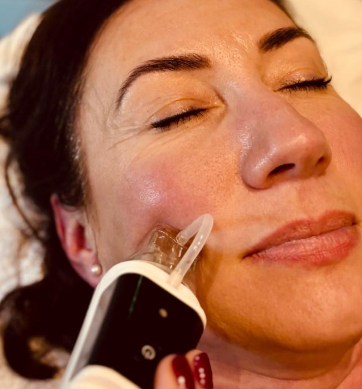 DERMAFORCE