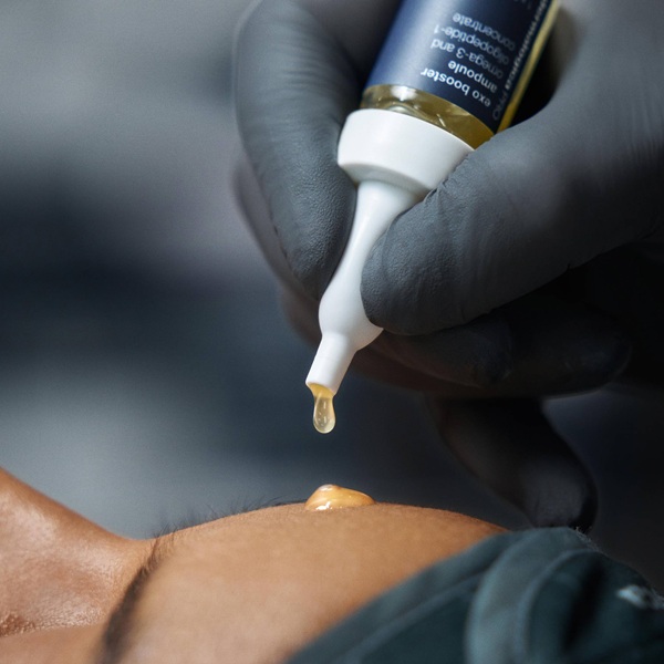 MICRONEEDLING